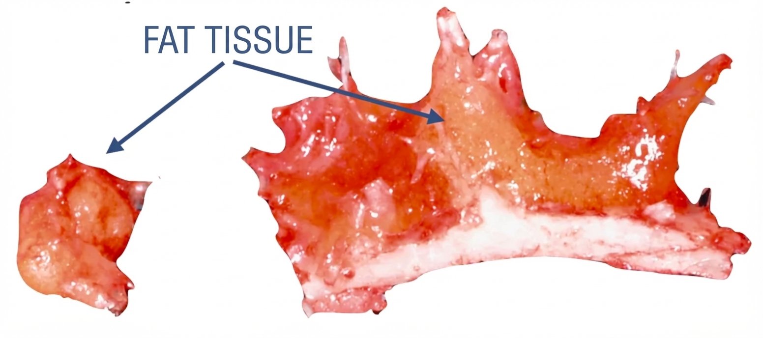 Bone fragment with visible fat