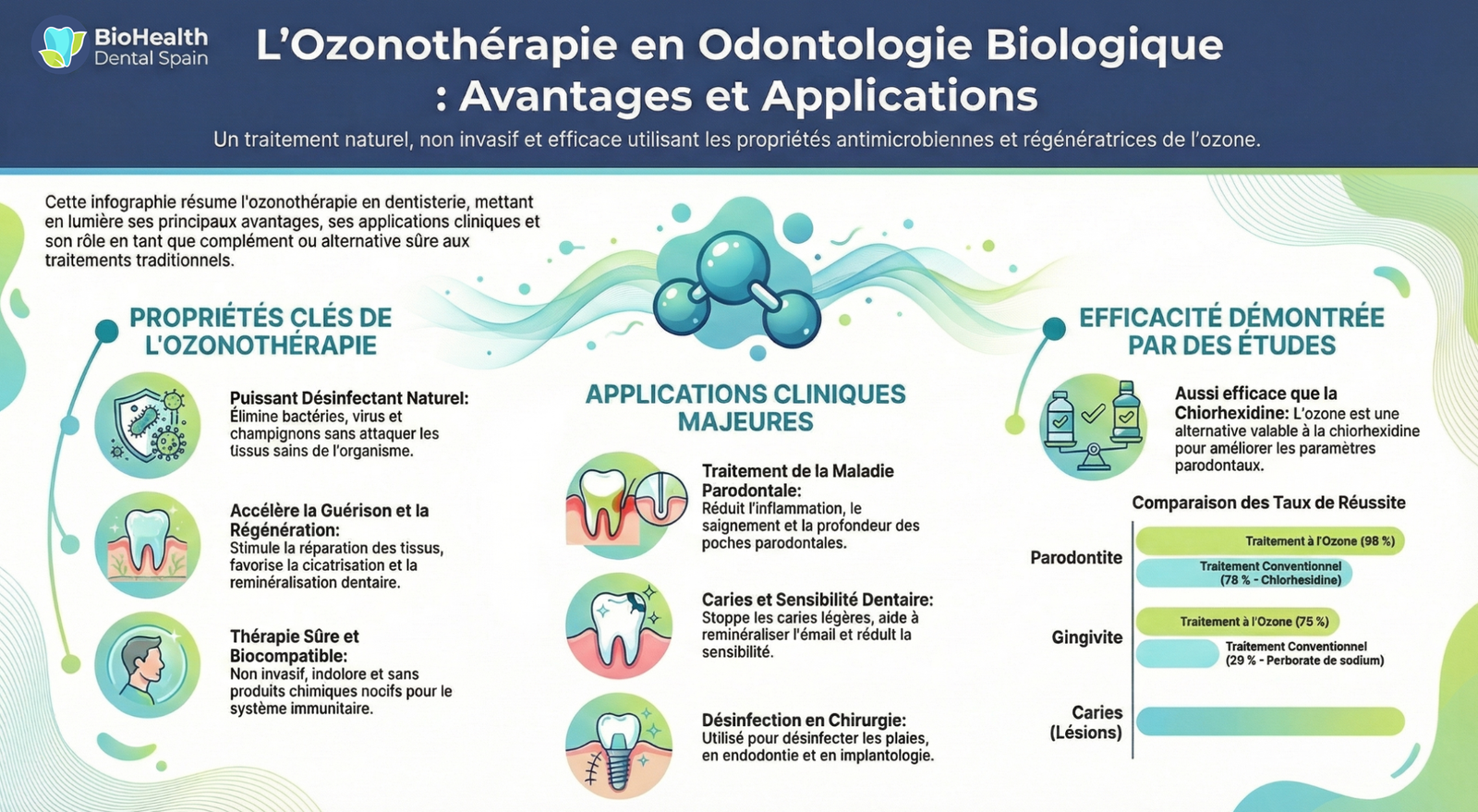Infographie complète sur l’ozonothérapie dentaire